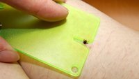 Zecken richtig entfernen - Wie gelingt es am besten?