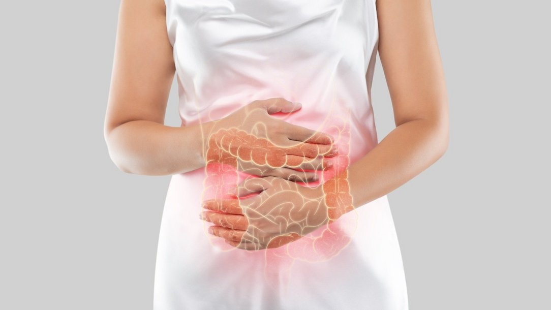 Colitis ulcerosa: chronisch-entzündliche Darmerkrankung Colitis ulcerosa: chronisch-entzündliche Darmerkrankung