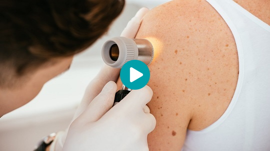 Video Hautkrebs